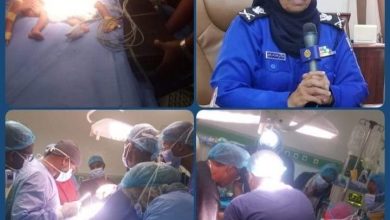 بطاقم طبي وطني..نجاح عملية فصل توأم سيامي بمستشفى الرباط 2 المسار نيوز بطاقم طبي وطني..نجاح عملية فصل توأم سيامي بمستشفى الرباط