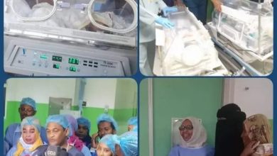 طاقم طبي شرطي ينجح في اجراء عملية فصل توأم سيامي (تالا وتالين) بمستشفي الشرطة 4 المسار نيوز طاقم طبي شرطي ينجح في اجراء عملية فصل توأم سيامي (تالا وتالين) بمستشفي الشرطة